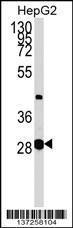 Anti-GLYCTK Rabbit Polyclonal Antibody (AP (Alkaline Phosphatase))