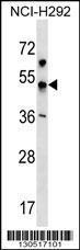 Anti-KCNJ18 Rabbit Polyclonal Antibody (AP (Alkaline Phosphatase))