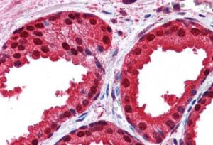 Anti-PARK7 Antibody (A83672) (3.75 µg/ml) staining of paraffin embedded Human Prostate. Steamed antigen retrieval with citrate buffer pH 6, AP-staining