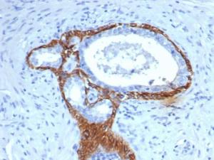 Anti-Cytokeratin 14 antibody