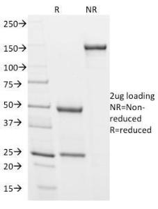 SDS-PAGE analysis of Anti-Podocalyxin Antibody [3D3] under non-reduced and reduced conditions; showing intact IgG and intact heavy and light chains, respectively. SDS-PAGE analysis confirms the integrity and purity of the antibody.