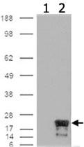 Anti-BIRC5 Mouse Monoclonal Antibody [clone: 60.11]