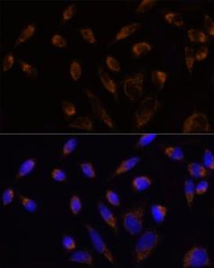 Immunofluorescence analysis of HeLa cells using Anti-TOMM20 Antibody (A309190) at a dilution of 1:100 (40X lens). DAPI was used to stain the cell nuclei (blue)