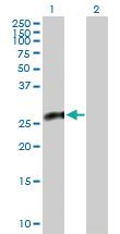 Anti-CACYBP Mouse Polyclonal Antibody