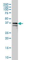 Anti-ARMCX3 Mouse Monoclonal Antibody [clone: 2G3]