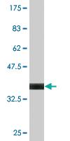 Anti-PIAS1 Mouse Monoclonal Antibody [clone: 4A4]