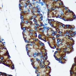 Immunohistochemistry analysis of paraffin-embedded rat pancreas using Anti-IER5 Antibody (A305383) at a dilution of 1:100 (40X lens). Perform microwave antigen retrieval with 10 mM PBS buffer pH 7.2 before commencing with IHC staining protocol