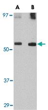 Anti-GDF6 Rabbit Polyclonal Antibody