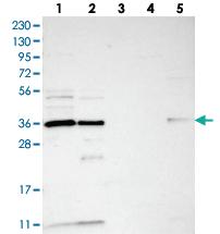 Anti-OTUD6B Rabbit Polyclonal Antibody