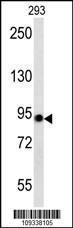 Anti-ACO2 Rabbit Polyclonal Antibody