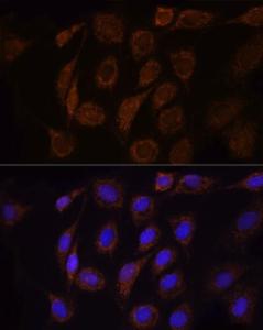 Immunofluorescence analysis of NIH/3T3 cells using Anti-TOMM20 Antibody (A309190) at a dilution of 1:100 (40X lens). DAPI was used to stain the cell nuclei (blue)