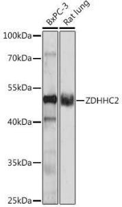 Anti-ZDHHC2 antibody