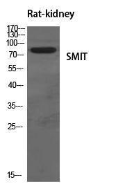 Antibody anti-SLC5A3 100 µg