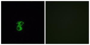 Immunofluorescence analysis of MCF7 cells using Anti-OR6B2 Antibody. The right hand panel represents a negative control, where the antibody was pre-incubated with the immunising peptide.