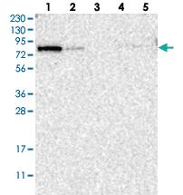 Anti-KLHL14 Rabbit Polyclonal Antibody