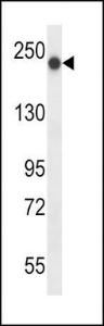 Anti-BRIP1 Rabbit Polyclonal Antibody