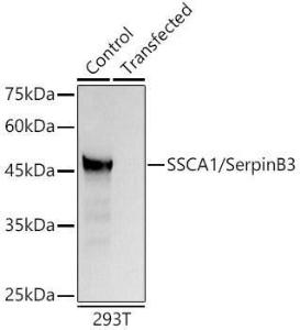 Western blot analysis of 293T, using Anti-SerpinB3/SCCA Antibody (A9707) at 1:1,000 dilution