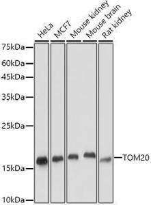 Western blot analysis of extracts of various cell lines, using Anti-TOMM20 Antibody [ARC5002-01] (A309191) at 1:5,000 dilution The secondary antibody was Goat Anti-Rabbit IgG H&L Antibody (HRP) at 1:10,000 dilution Lysates/proteins were present at 25 µg per lane