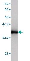 Anti-S100 A10 Mouse Monoclonal Antibody [clone: 4D2-F1]