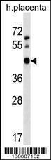 Anti-APOBEC3D Rabbit Polyclonal Antibody