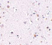 Anti-NUP160 Rabbit Polyclonal Antibody