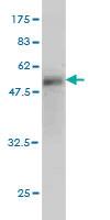 Anti-WISP2 Mouse Monoclonal Antibody [clone: 3D10]