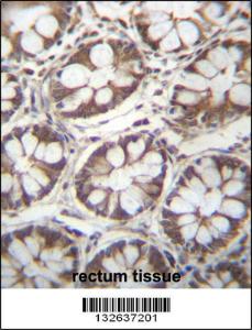 Anti-LAD1 Rabbit Polyclonal Antibody (FITC (Fluorescein Isothiocyanate))