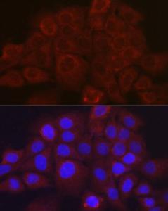 Immunofluorescence analysis of A431 cells using Anti-SerpinB3/SCCA Antibody (A9707) at a dilution of 1:100 (40X lens). DAPI was used to stain the cell nuclei (blue)