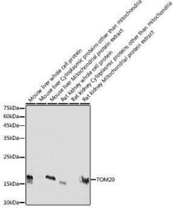 Western blot analysis of extracts of various cell lines, using Anti-TOMM20 Antibody [ARC5002-01] (A309191) at 1:5,000 dilution The secondary antibody was Goat Anti-Rabbit IgG H&L Antibody (HRP) at 1:10,000 dilution Lysates/proteins were present at 25 µg per lane