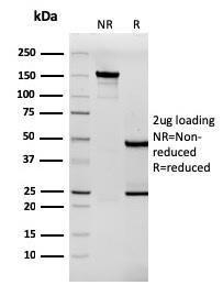 SDS-PAGE analysis of Anti-Tenascin C Antibody [rTNC/3635] under non-reduced and reduced conditions; showing intact IgG and intact heavy and light chains, respectively SDS-PAGE analysis confirms the integrity and purity of the antibody