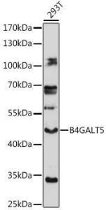 Western blot analysis of extracts of 293T cells, using Anti-B4GALT5 Antibody (A306287) at 1:1000 dilution