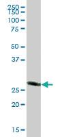 Anti-CACYBP Mouse Polyclonal Antibody