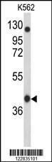 Anti-APOBEC3F Rabbit Polyclonal Antibody (AP (Alkaline Phosphatase))