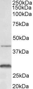 Anti-Cxcr2 Antibody (A83674) (0.3 µg/ml) staining of Mouse Colon lysate (35 µg protein in RIPA buffer). Primary incubation was 1 hour. Detected by chemiluminescence