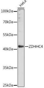 Western blot analysis of extracts of HeLa cells, using Anti-ZDHHC4 / DC1 Antibody (A93357) at 1:1000 dilution