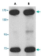 Anti-NUP160 Rabbit Polyclonal Antibody