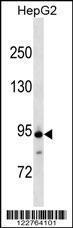 Anti-ANAPC4 Rabbit Polyclonal Antibody (HRP (Horseradish Peroxidase))