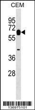 Anti-MYOT Rabbit Polyclonal Antibody