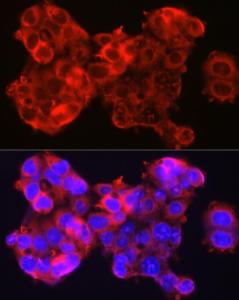 Immunofluorescence analysis of HepG2 cells using Anti-SerpinB3/SCCA Antibody (A9707) at a dilution of 1:100 (40X lens). DAPI was used to stain the cell nuclei (blue)