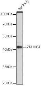 Western blot analysis of extracts of Rat lung, using Anti-ZDHHC4 / DC1 Antibody (A93357) at 1:1000 dilution