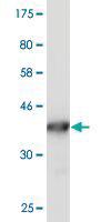 Anti-S100 A10 Mouse Monoclonal Antibody [clone: 3E10]