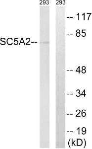 Anti-SGLT2 Rabbit Polyclonal Antibody