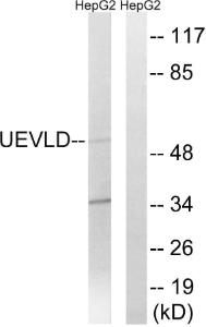 Western blot analysis of lysates from HepG2 cells using Anti-UEVLD Antibody. The right hand lane represents a negative control, where the antibody is blocked by the immunising peptide.