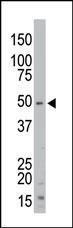 Anti-STK35 Rabbit Polyclonal Antibody (PE (Phycoerythrin))