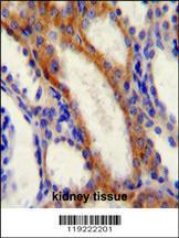 Anti-STIM1 Rabbit Polyclonal Antibody