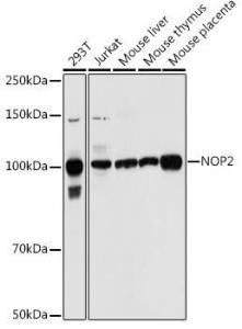 Western blot analysis of extracts of various cell lines, using Anti-NOP2 Antibody (A306288) at 1:1,000 dilution The secondary antibody was Goat Anti-Rabbit IgG H&L Antibody (HRP) at 1:10,000 dilution Lysates/proteins were present at 25 µg per lane