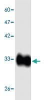 Anti-HAVgp2 Mouse Monoclonal Antibody [clone: 88s65]