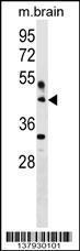 Anti-HAPLN4 Rabbit Polyclonal Antibody (AP (Alkaline Phosphatase))