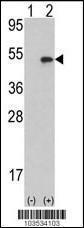 Anti-AURKB Rabbit Polyclonal Antibody (Biotin)