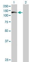 Anti-WDR66 Mouse Polyclonal Antibody